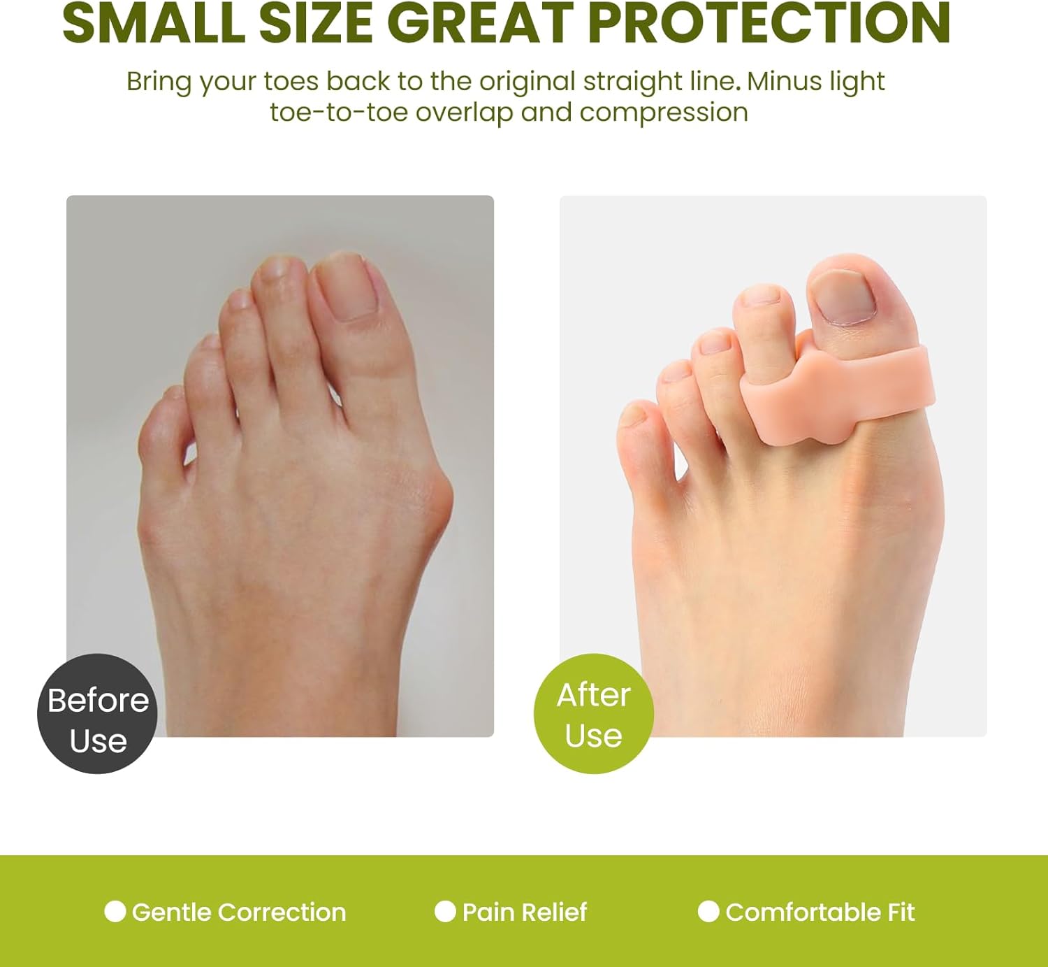 Bukihome Pack of 8 Bunion Corrector, Toe Separators with 2 Loops, Big Toe Spacer Suitable for Bunion and Overlap Toe (Beige)