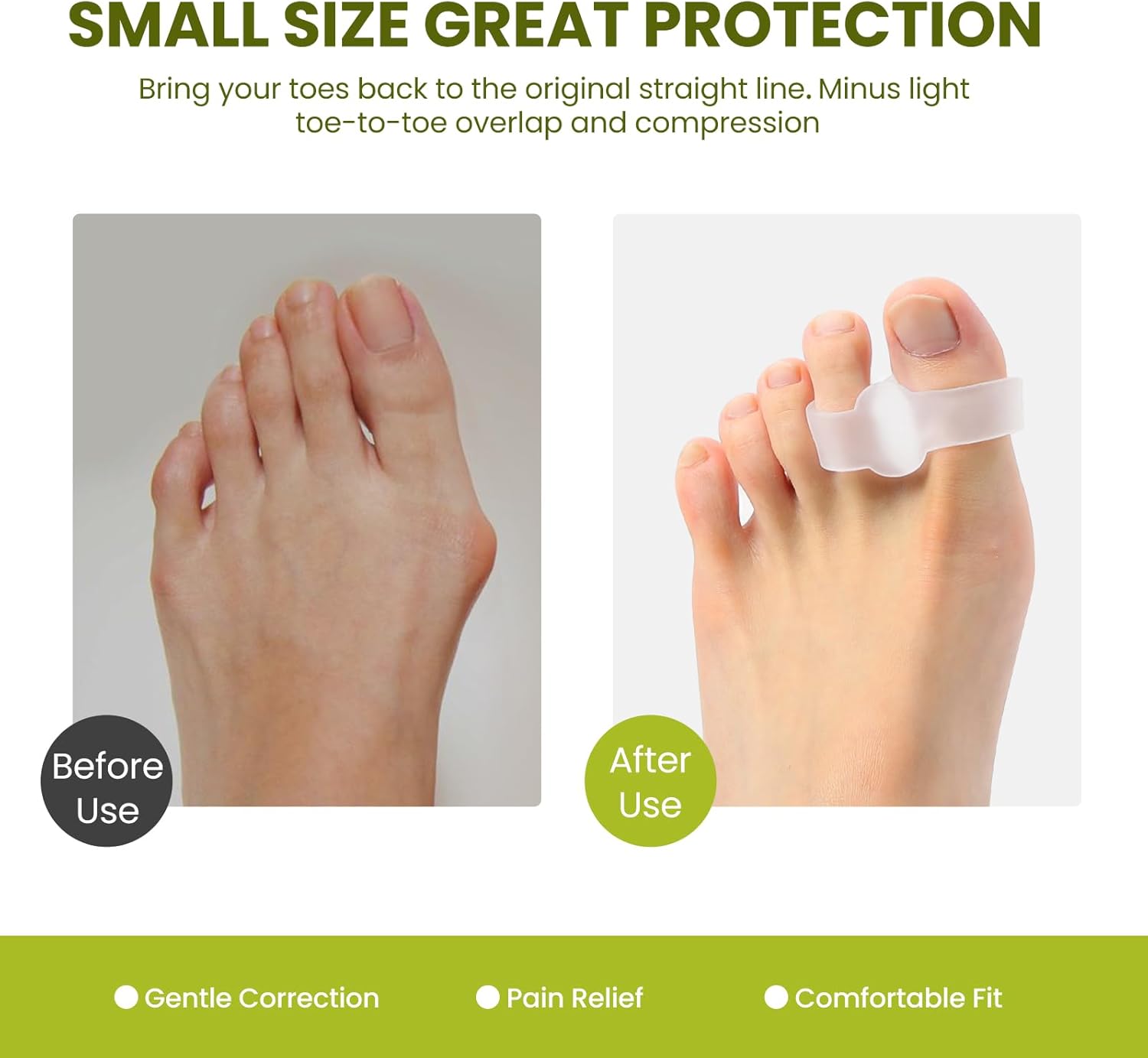 Bukihome Toe Separators Bunion Corrector - 8 Pack Big Toe Spacers with Aloe Vera Extract, Suitable for Bunion and Overlapping Toes, Reduce Foot Pain(Clear)