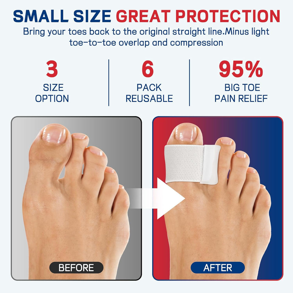 Big Toe Spacers,Hallux Valgus Corrector,Relieve Bunion Pain,Prevent Overlapping Toes, All-Day Comfort for Men & Women, Fits in Shoes.