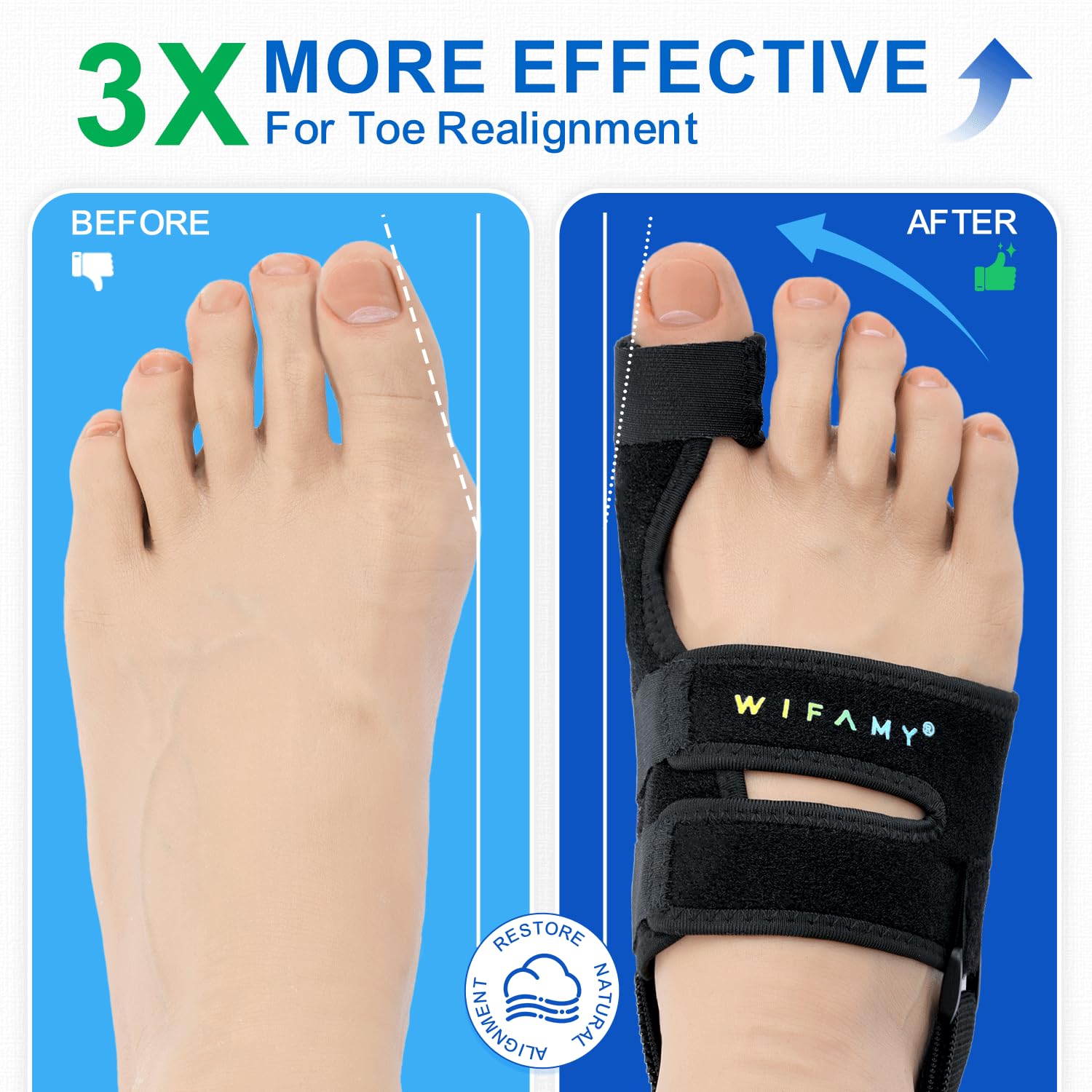 Bunion Corrector For Women Big Toe: Soft Gel Toe Separators For Women - Adjustable Straps & Breathable Design - Day/Night Pain Relief For High Heels & Flats