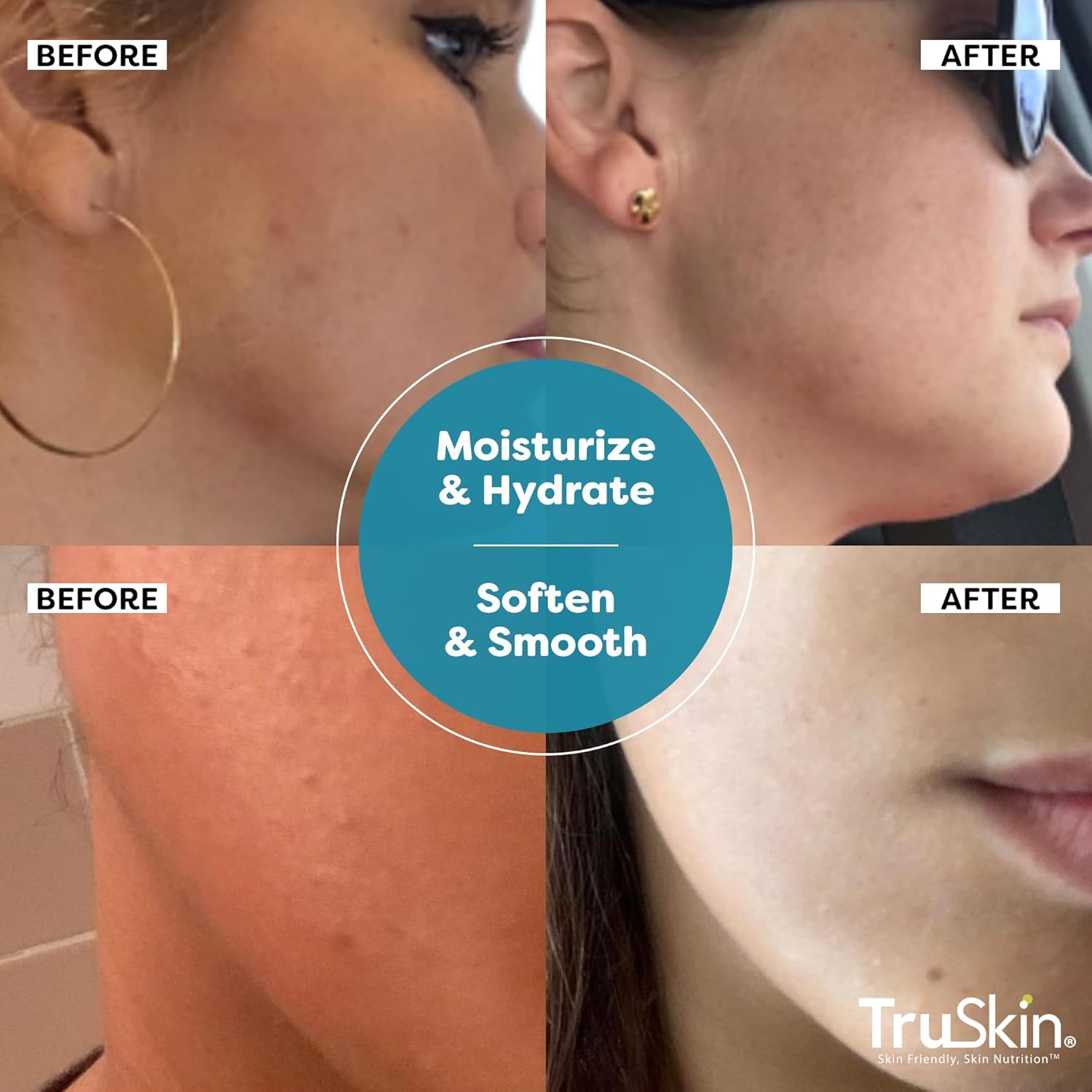 TruSkin Hyaluronic Acid Serum for Face + 7 Ultra Hydrating Ingredients – Best Face Serum for Moisturizing, Visibly Plumping Skin & Smoothing the Look of Fine Lines, 2 fl oz