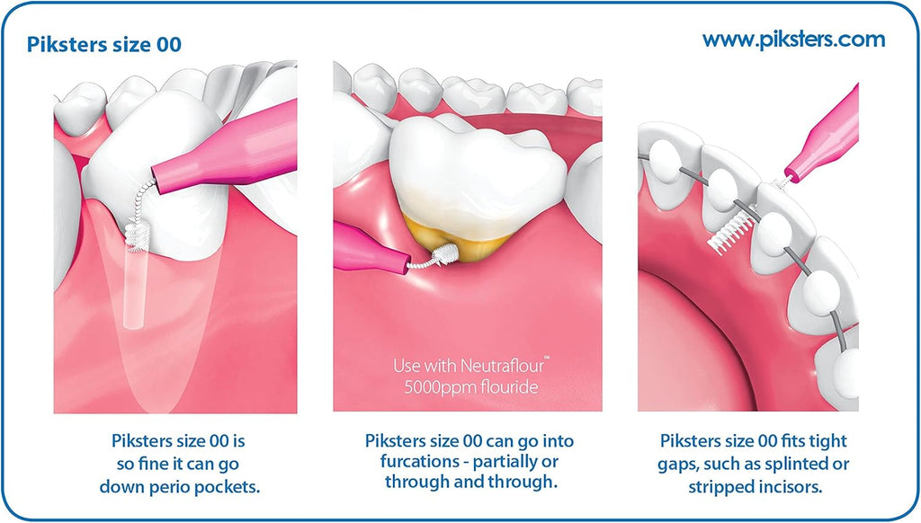 Piksters Interdental Brushes, 40 pk, Size 00, Interdental Tooth Brush for Extremely Tight Gaps, Gum Soft Bristles for Plaque Removal, Safe for Braces