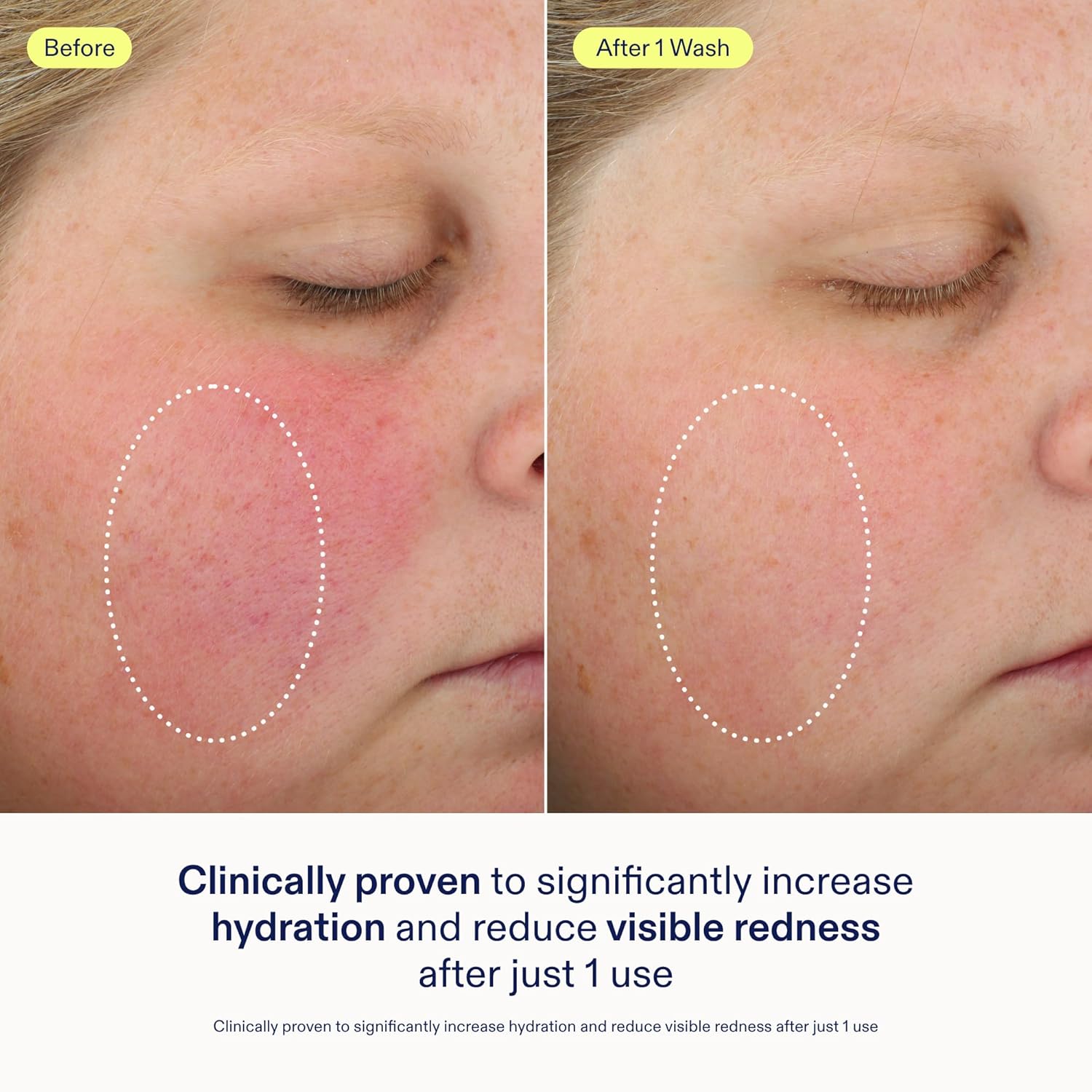 Skinfix Foaming Oil Cleanser - 6 oz - Rich Gel-to-Foam Face Cleanser to Hydrate & Soothe Dry, Sensitive Skin - Fragrance Free, Vegan, Cruelty Free