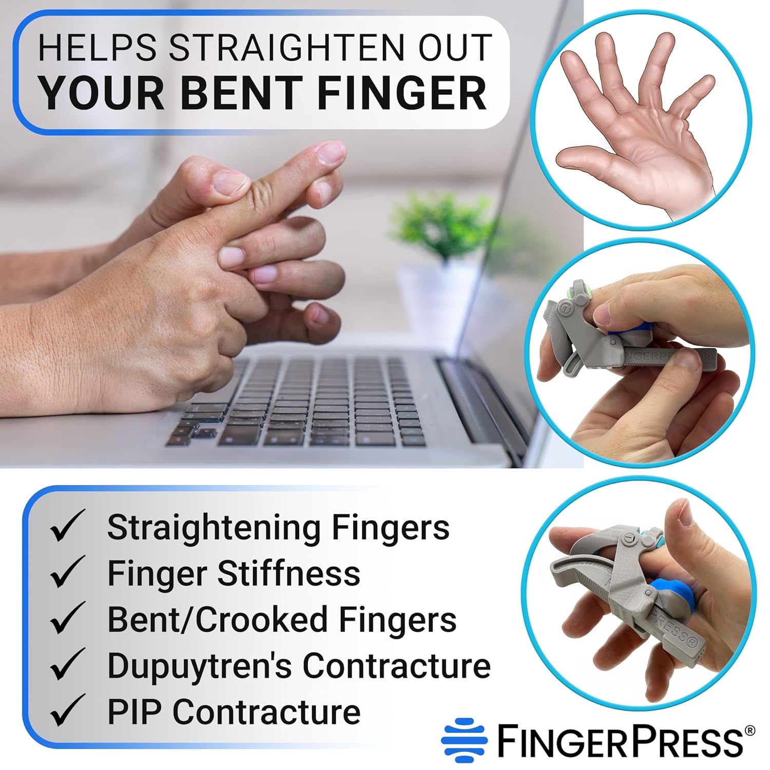 Finger Straightener | PIP Extension Orthosis/Splint For Bent Fingers, PIP Flexion Contractures | Adjustable Joint Stretcher Device | Made in USA | Black/X-Large