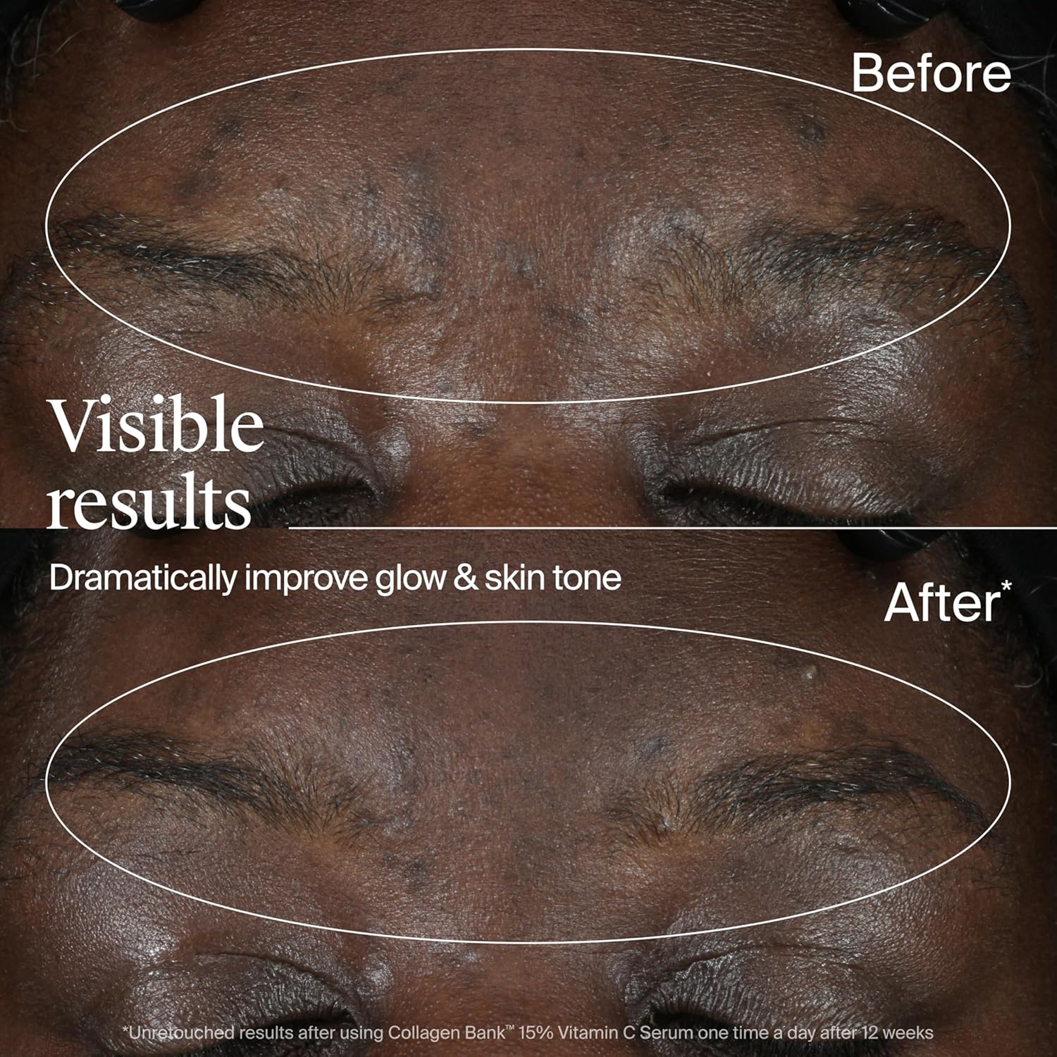 Neutrogena Collagen Bank 15% Vitamin C Face Serum, Vitamin C Serum for Face Helps Build Collagen for Glowing, Plumper Looking Skin, Uneven Skin Tone Treatment, Fragrance Free, 0.5 fl. oz