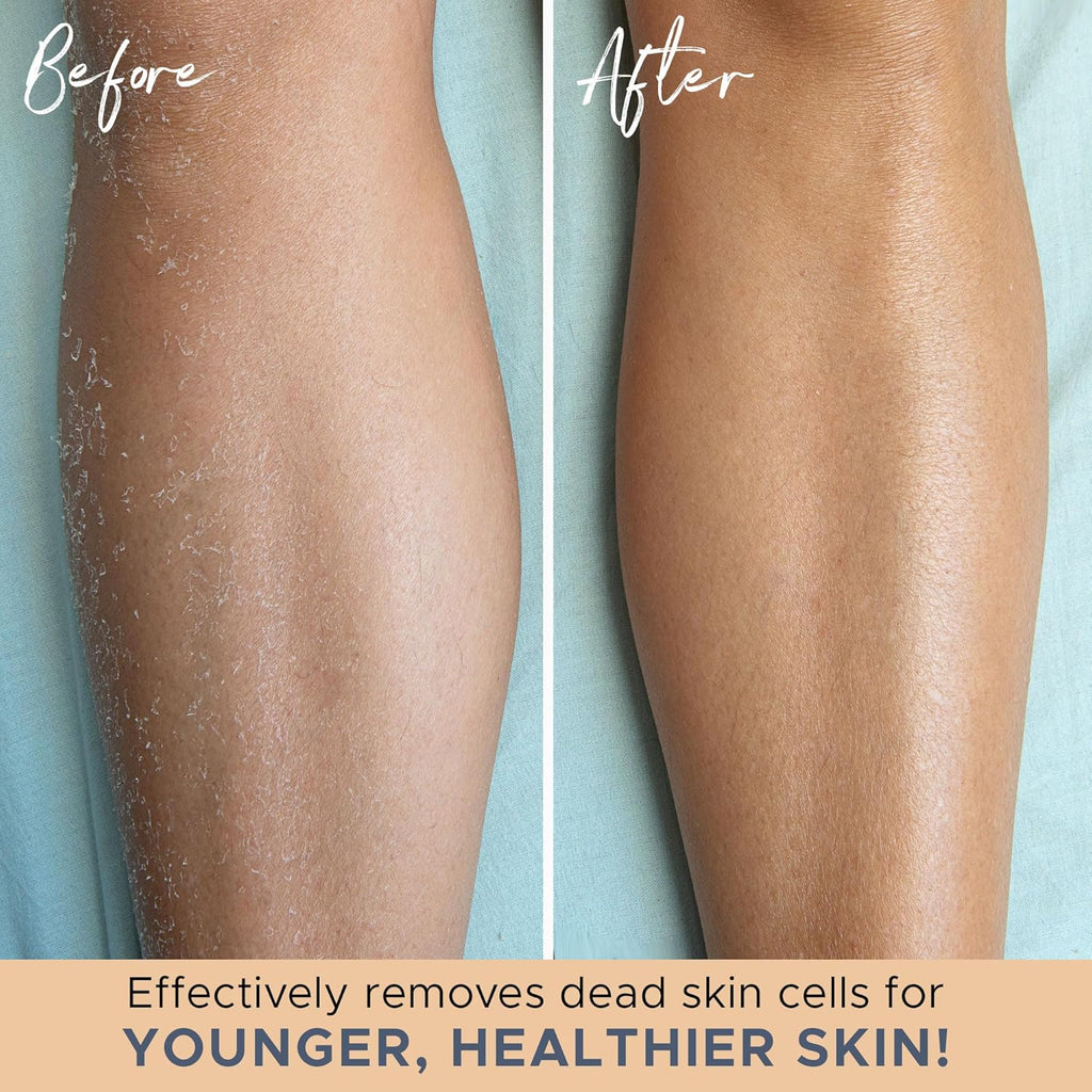 Exfoliating Glove (4 pcs, 2 Pairs) - Medium Shower Gloves for Body Scrub, Exfoliates & Removes Dead Skin